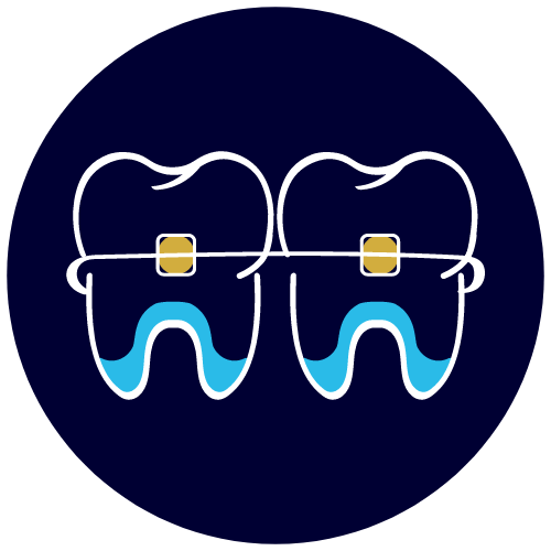 En orthodontie, correction des problèmes de mauvaise occlusion dentaire et de mauvaise position des dents et des mâchoires.
